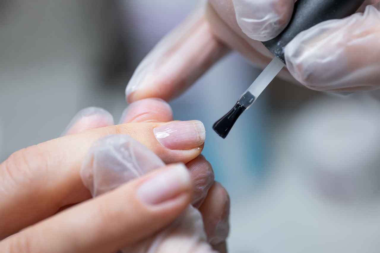 Risultato ricostruzione gel
